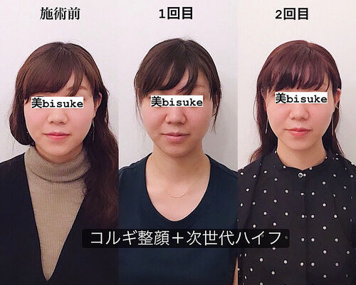 3C03235F-F4A9-4C1C-8A98-4620AE2A2C8B