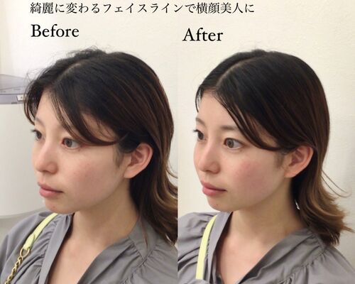 EE9D5585-848A-4794-86B9-2665F328BC0B