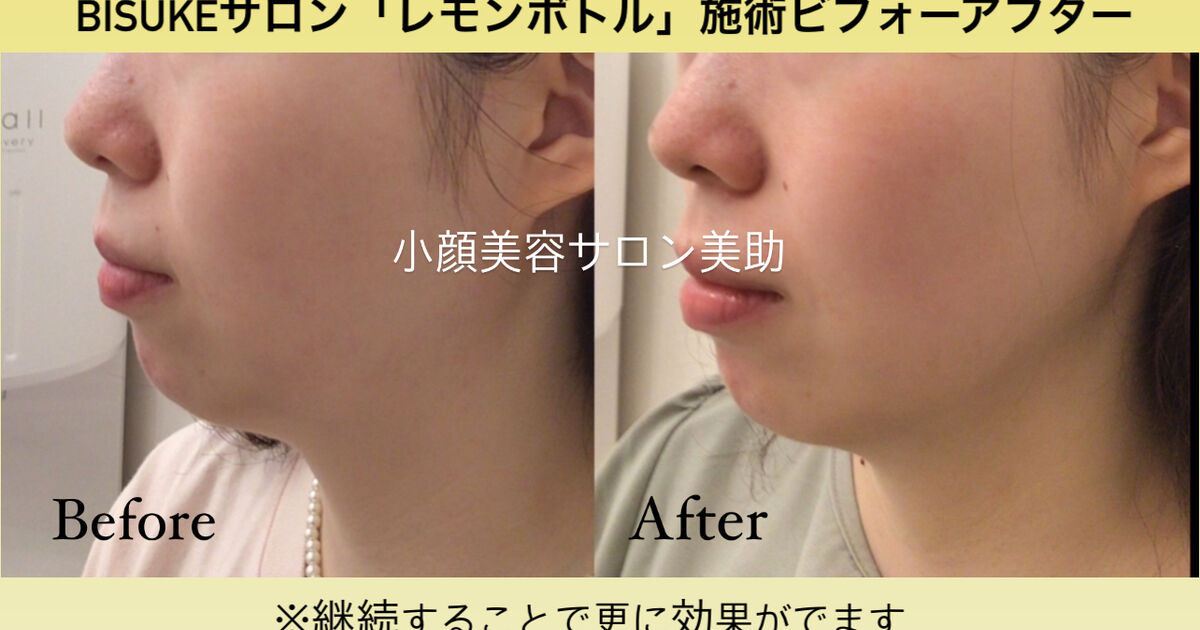 レモンボトルの効果「ビフォーアフター」 | ブログ