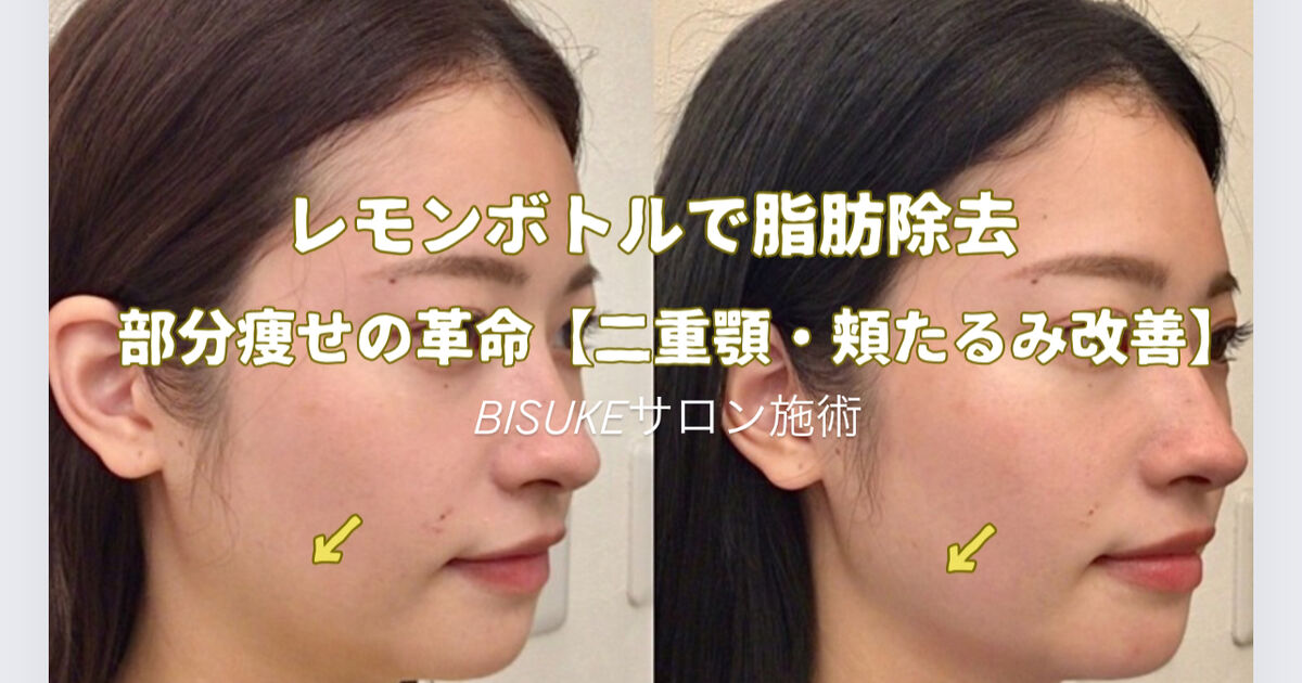 部分痩せレモンボトル「二重あご改善」ビフォーアフター | ブログ
