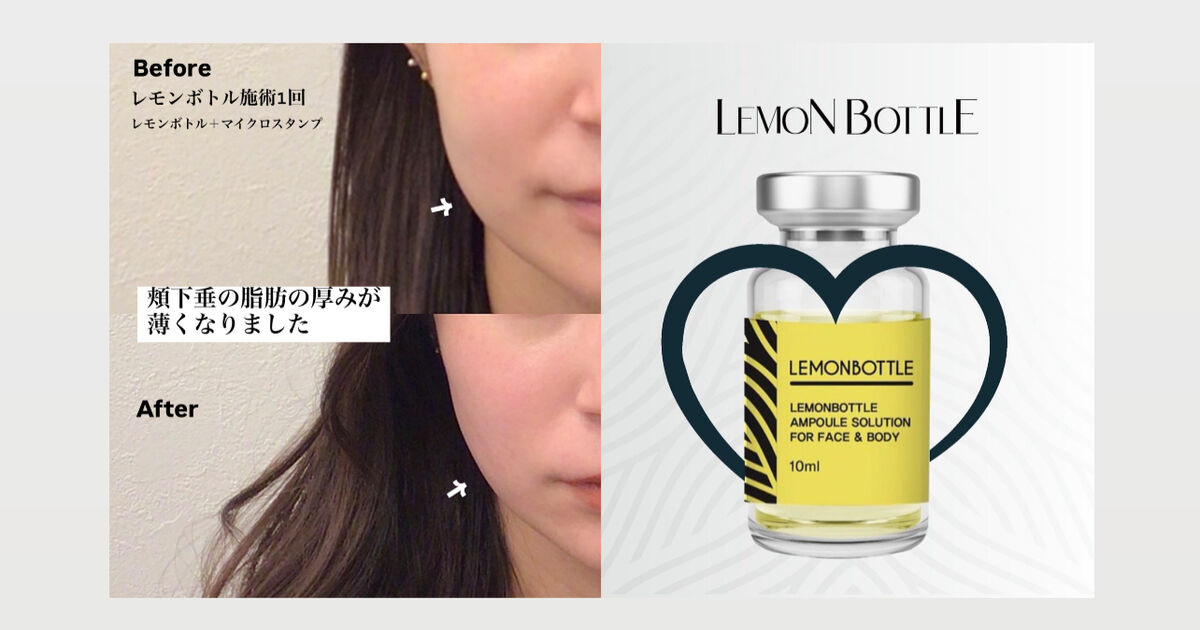 ハイドラペンH5 美容液導入ナノスタンプペン マイクロカレント付き　レモンボトル ハイドラペン(美容液タンク付きセルフダーマペン)の解説☆購入する前に