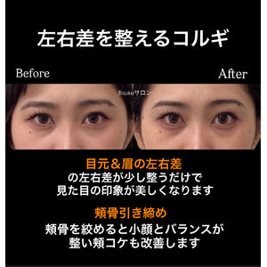 フェムランテ　ダブルリペアクリーム バイオプロポーザー フェムランテ ダブルリペアクリーム