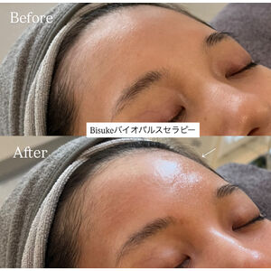 シワ改善」フェムランテダブルリペアクリーム | ブログ