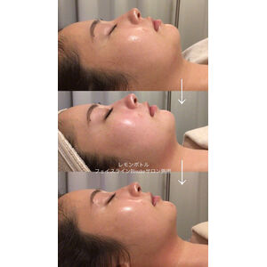 62B1D488-F35D-4318-ADB4-BD8777CD16ED