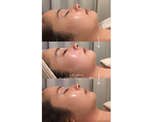 62B1D488-F35D-4318-ADB4-BD8777CD16ED