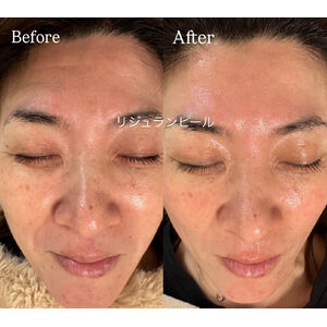 シワ改善」フェムランテダブルリペアクリーム | ブログ