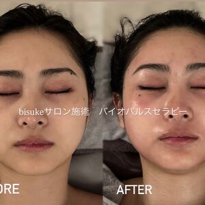 次世代エクソソーム&バクチオール」リペアクリーム | ブログ