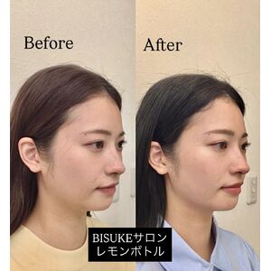 圧倒的な保湿力「クロセルテラピークリーム」バイオプロポーザー | ブログ