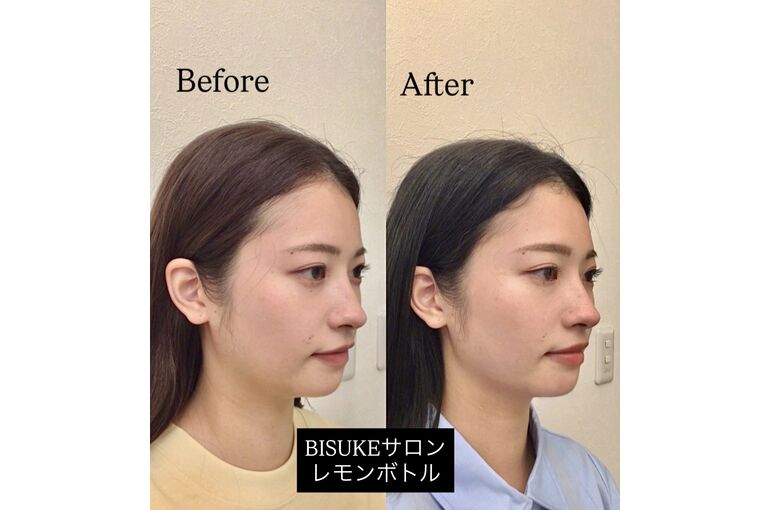 お正月明けはレモンボトルで脂肪分解 | ブログ