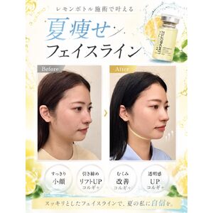 圧倒的な保湿力「クロセルテラピークリーム」バイオプロポーザー | ブログ