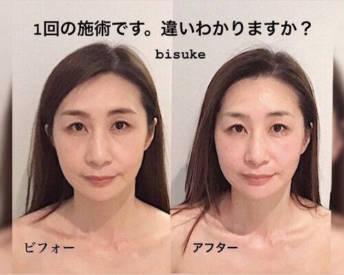 C90367F2-7255-4CE4-8405-F9E1B07009CC